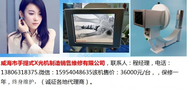 手提式X光机 (7)