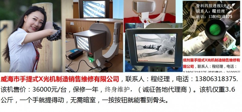 手提式X光机 (12)